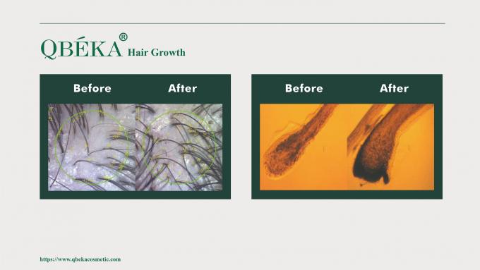 GMPC Standard Shampoo для профилактики выпадения волос для лечения выпадения волос и истончения 80м 11